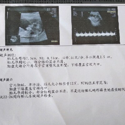 两个月胎儿图片