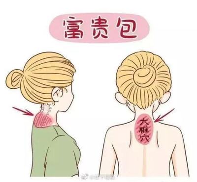 颈椎长个包是怎么回事