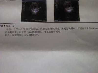 怀孕10周图片