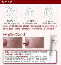上海治痘痘8号