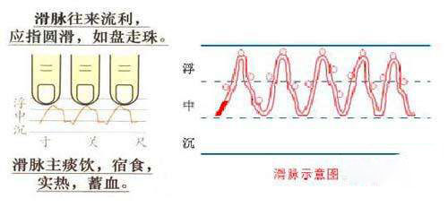 怀孕脉象图解