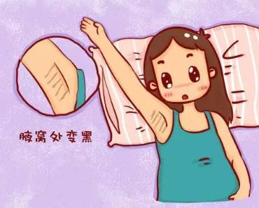 怀孕腋下黑色素沉淀怎么去除