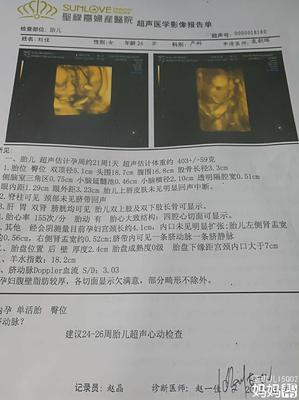 孕妇肾盂分离是什么意思