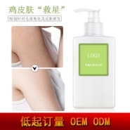 果酸身体乳去痘痘