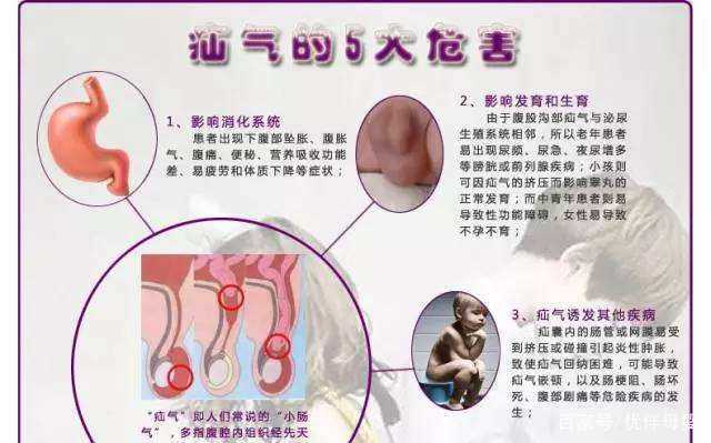 小儿疝气是怎么回事