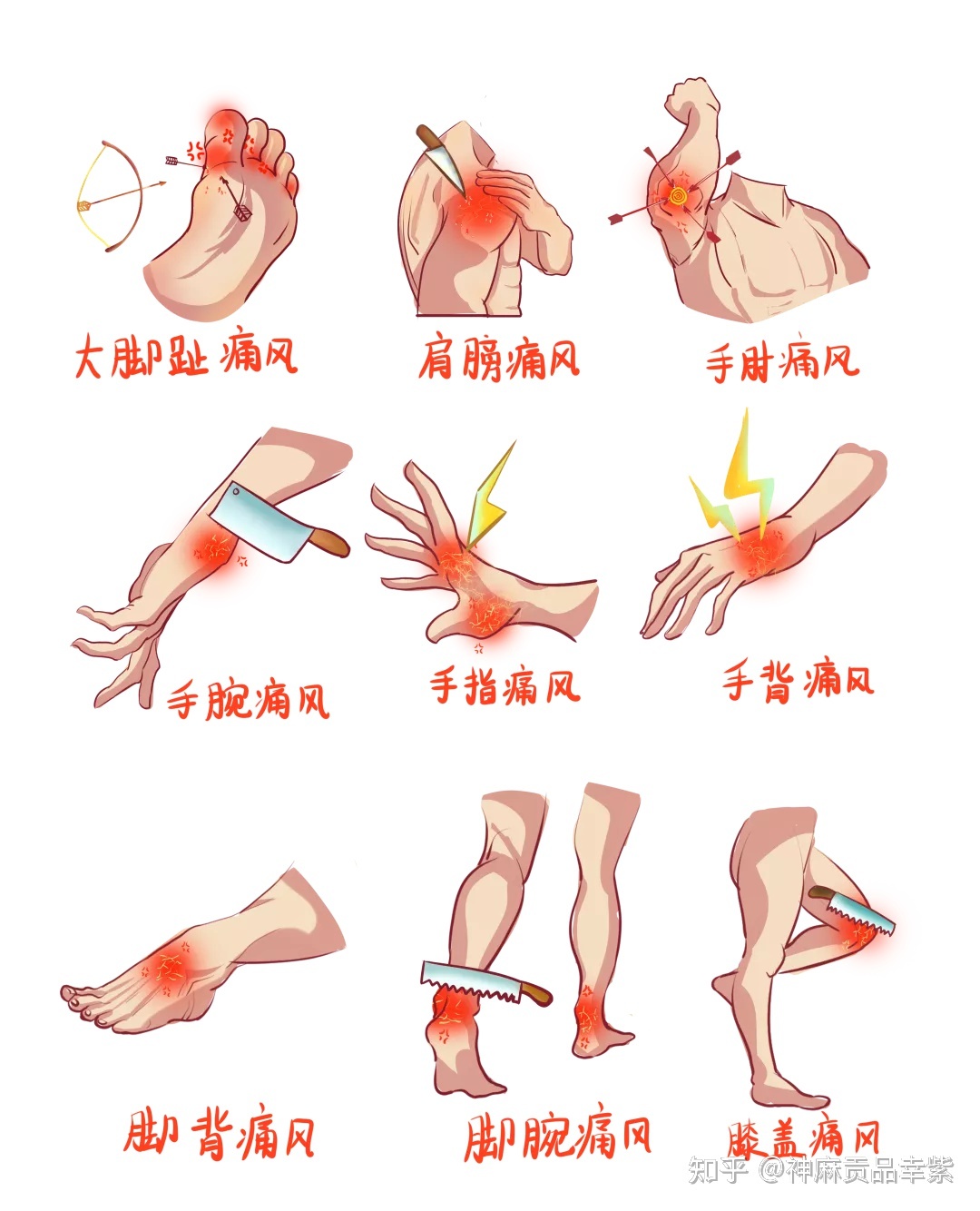 膝盖疼肿怎么治疗