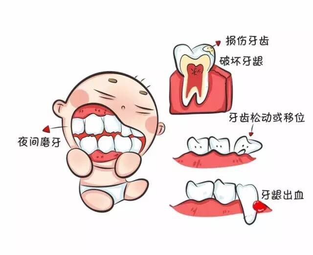 一岁宝宝牙龈出血