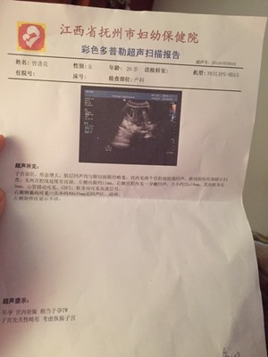 彩超 怀孕