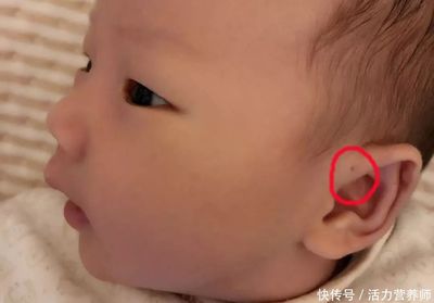 聪明孔是怎么回事