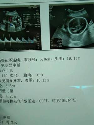 怀孕22周胎动频繁正常吗