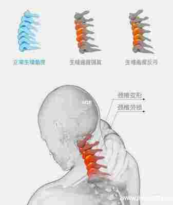 尾椎骨旁边疼是怎么回事