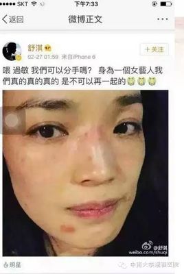 护肤品用了几天才过敏