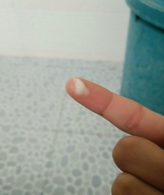 排卵期有白色豆腐渣样
