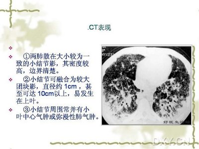 肺结节影是什么意思啊怎么治疗