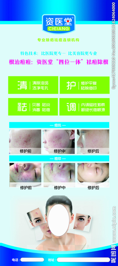 美容院能治好痘痘吗