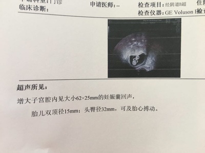 孕酮吃多了对胎儿有影响吗
