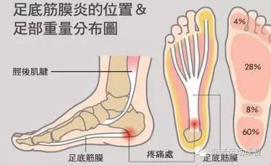 足底疼是怎么回事