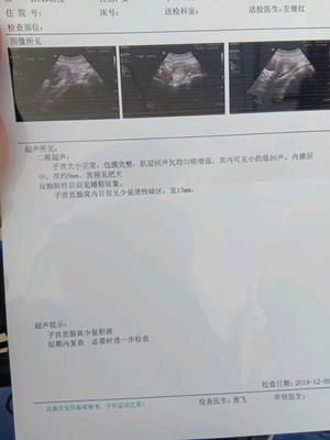 怀孕流褐色血