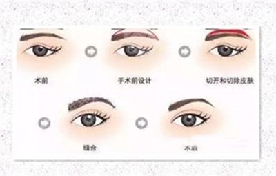 绣眉多久可以补色