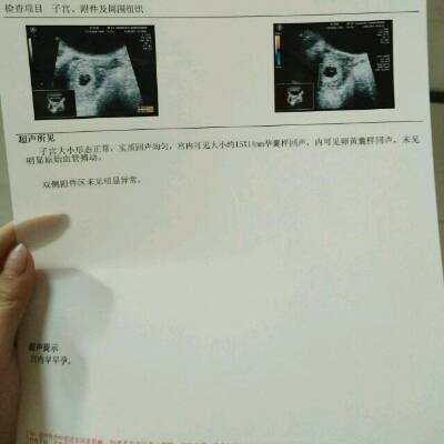 怀孕4周可以药流吗
