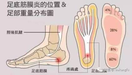 足底疼是怎么回事