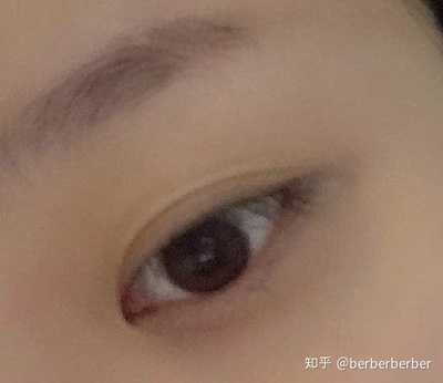双眼皮什么时候贴