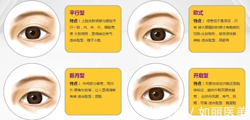 双眼皮有哪几种形状