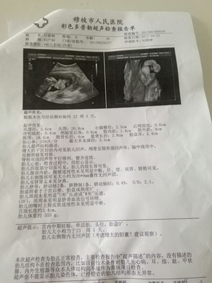 胎儿胆道闭锁的原因
