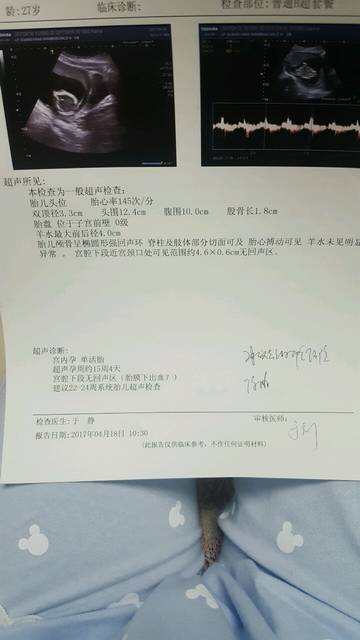 怀孕15周宝宝多大
