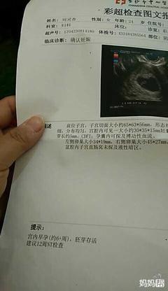 宝宝几周有胎心