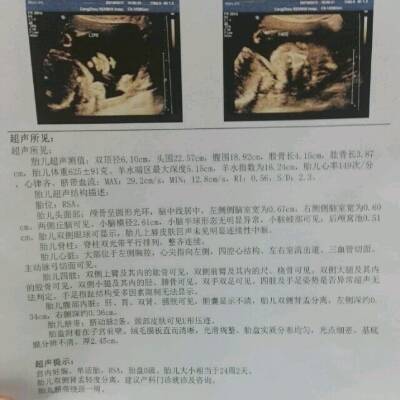 孕妇肾盂分离是什么意思