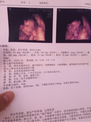 怀孕了怎么看男女