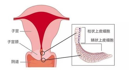 孕妇宫颈管正常是多少