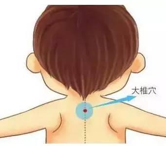 咳嗽 刮痧