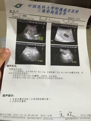 怀孕40天孩子多大