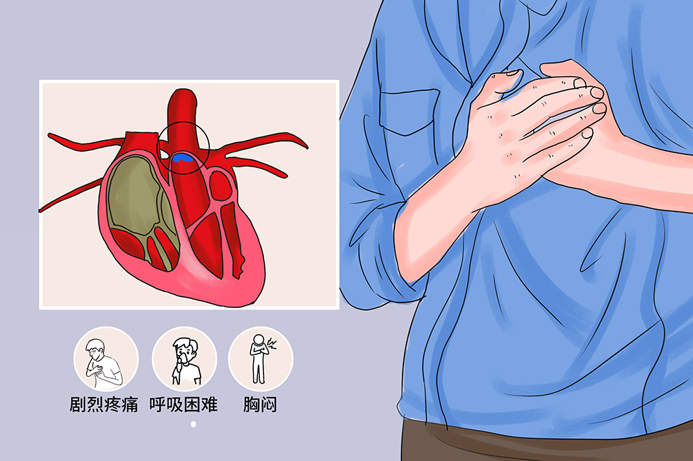 主动脉型心脏怎么治疗