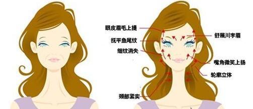 海薇玻尿酸怎么样