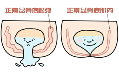 刮宫是怎么回事