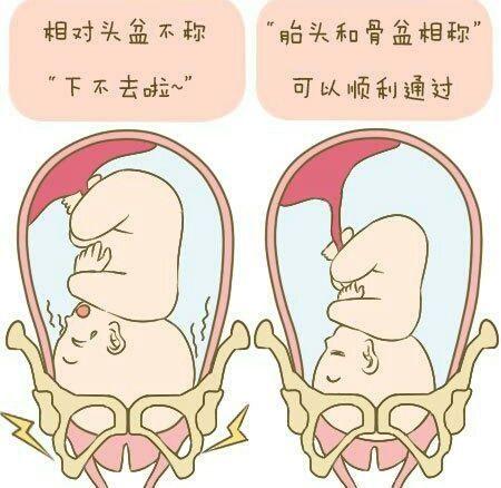 胎儿入盆需要几天完成