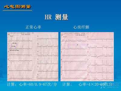 房颤一分钟心率是多少