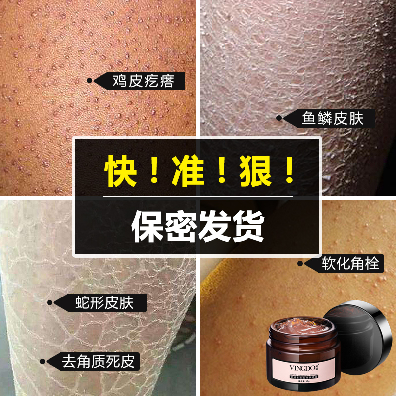 痘痘肌肤用什么牌子最好