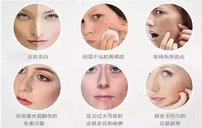 激光美白有用吗
