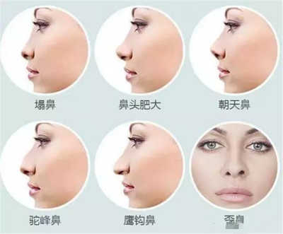 圆头鼻子的女人的面相