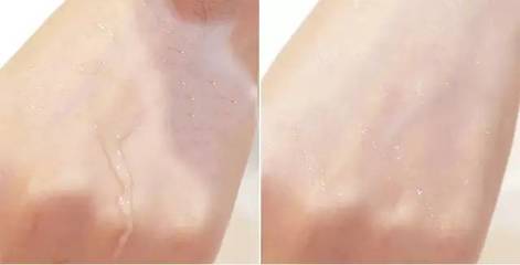 如何快速让痘痘消炎