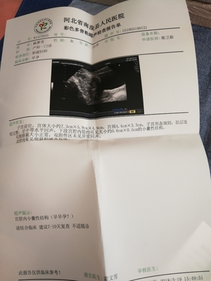 怀孕3个月孕囊多大