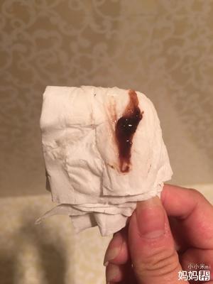 排卵期咖啡色白带