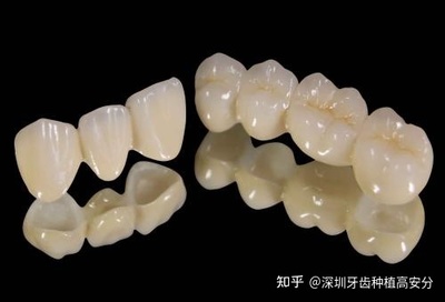 烤瓷牙崩瓷怎么修复