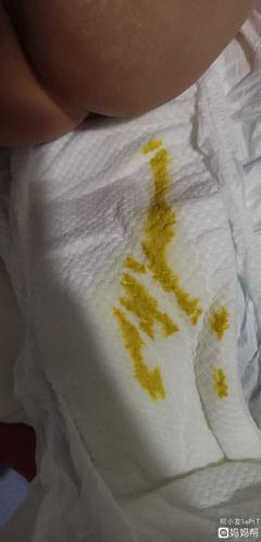 宝宝一天半没有大便了