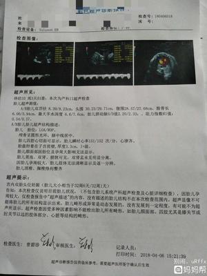 两个月胎儿真实图片