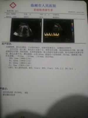 34周胎儿股骨长标准值